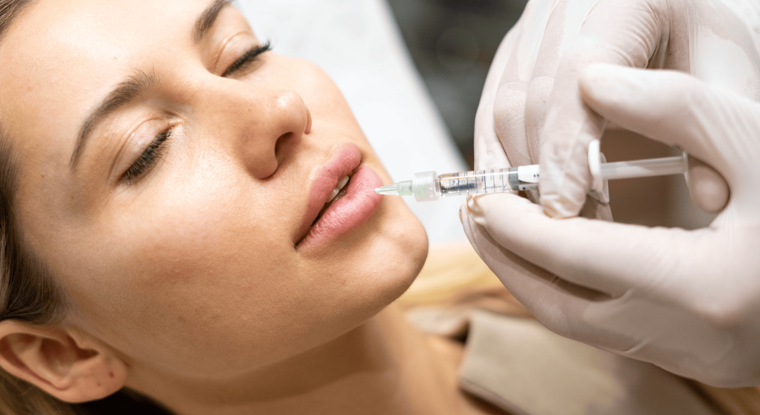 Lip Filler