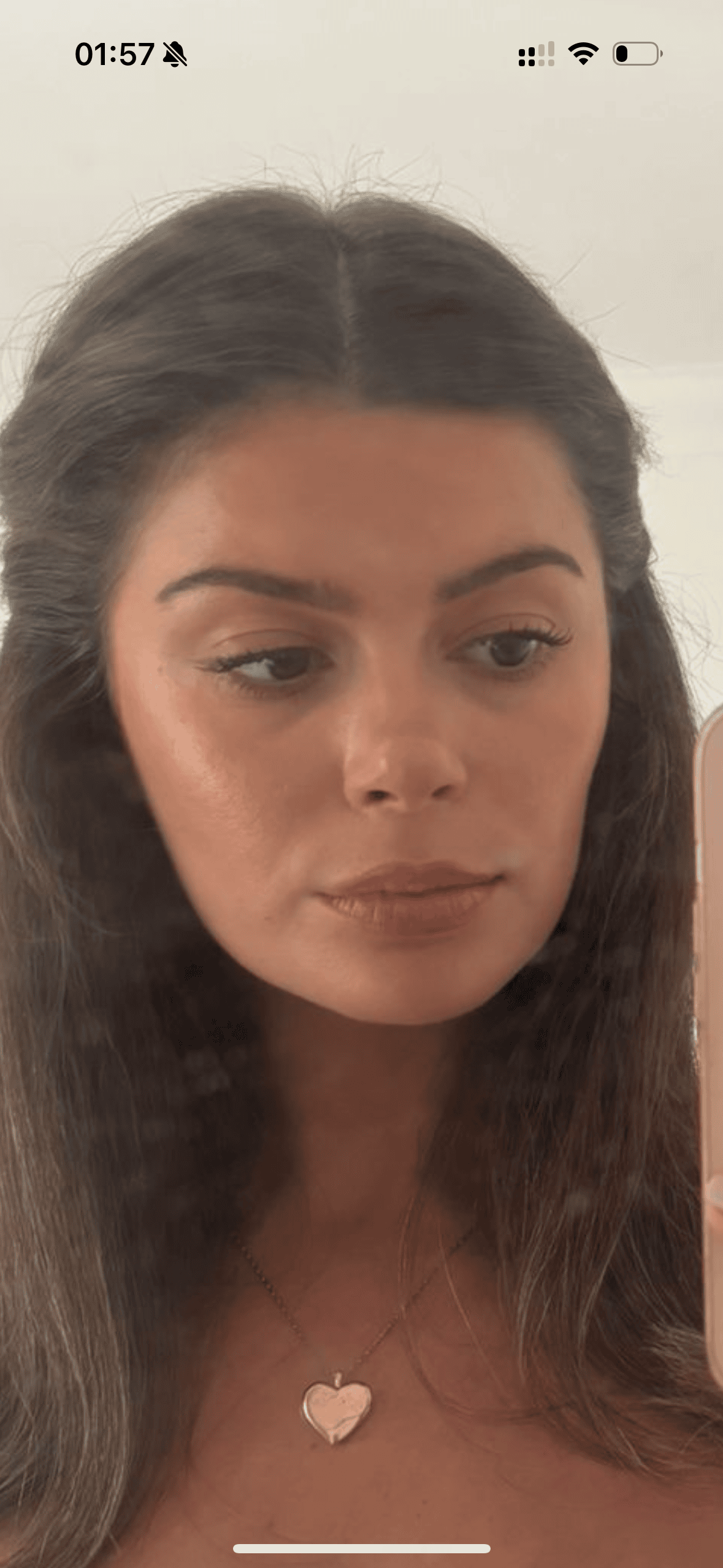 After Successful Masseter Botox Treatment