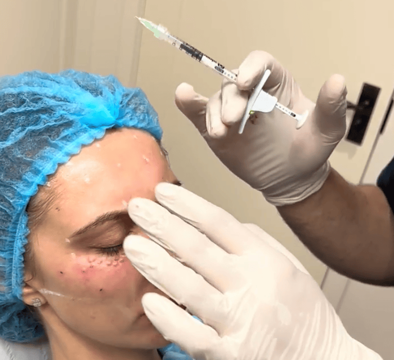 Metered dose syringe for botox training doctors London