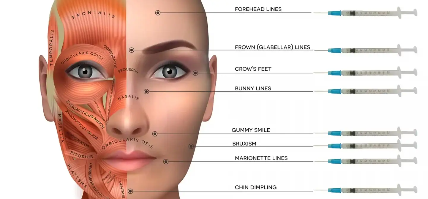 Botox training